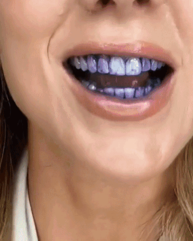 Smiley Whitening Purple Toothpaste, Purple toothpaste for teeth whitening, Teeth whitening toothpaste by Smiley, Smiley Purple Toothpaste for brighter teeth